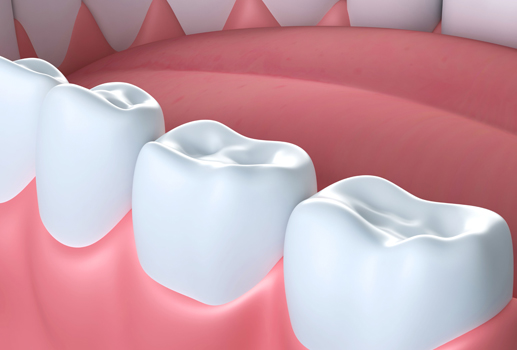 How Often Should You Whiten Your Teeth